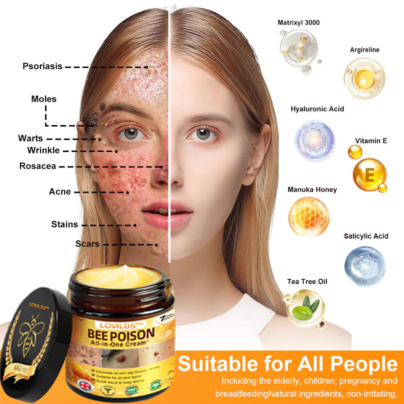 [𝐎𝐟𝐟𝐢𝐜𝐢𝐚𝐥 𝐁𝐫𝐚𝐧𝐝 𝐒𝐭𝐨𝐫𝐞] 🐝 LOVILDS™ 𝐁𝐞𝐞 𝐕𝐞𝐧𝐨𝐦 𝐀𝐥𝐥-𝐢𝐧-𝐎𝐧𝐞 𝐂𝐫𝐞𝐚𝐦 (👩‍⚕️ 𝐁𝐫𝐢𝐭𝐢𝐬𝐡 𝐀𝐜𝐚𝐝𝐞𝐦𝐲 𝐨𝐟 𝐃𝐞𝐫𝐦𝐚𝐭𝐨𝐥𝐨𝐠𝐲 𝟐𝟎𝟐𝟓 𝐒𝐩𝐞𝐜𝐢𝐚𝐥𝐥𝐲 𝐑𝐞𝐜𝐨𝐦𝐦𝐞𝐧𝐝𝐞𝐝 𝐏𝐫𝐨𝐝𝐮𝐜𝐭)