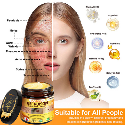 [𝐎𝐟𝐟𝐢𝐜𝐢𝐚𝐥 𝐁𝐫𝐚𝐧𝐝 𝐒𝐭𝐨𝐫𝐞] 🐝 LOVILDS™ 𝐁𝐞𝐞 𝐕𝐞𝐧𝐨𝐦 𝐀𝐥𝐥-𝐢𝐧-𝐎𝐧𝐞 𝐂𝐫𝐞𝐚𝐦 (👩‍⚕️ 𝐁𝐫𝐢𝐭𝐢𝐬𝐡 𝐀𝐜𝐚𝐝𝐞𝐦𝐲 𝐨𝐟 𝐃𝐞𝐫𝐦𝐚𝐭𝐨𝐥𝐨𝐠𝐲 𝟐𝟎𝟐𝟓 𝐒𝐩𝐞𝐜𝐢𝐚𝐥𝐥𝐲 𝐑𝐞𝐜𝐨𝐦𝐦𝐞𝐧𝐝𝐞𝐝 𝐏𝐫𝐨𝐝𝐮𝐜𝐭)