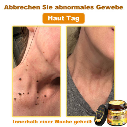 [offizieller Markenshop] 🐝 LOVILDS™ Bienengift-All-Action-Creme (👩‍⚕️ Deutsche Dermatologische Gesellschaft e.V. 𝟐𝟎𝟐𝟓Besonders empfehlenswerte Produkte)💟