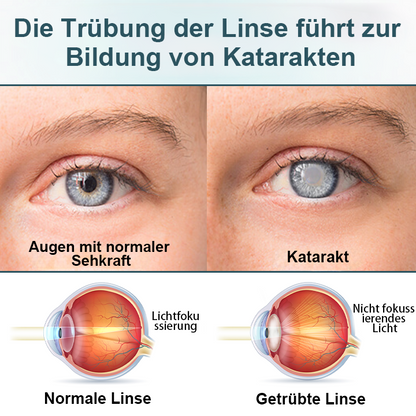 LOVILDS® OptiFusion Nano Augentropfen-Serum