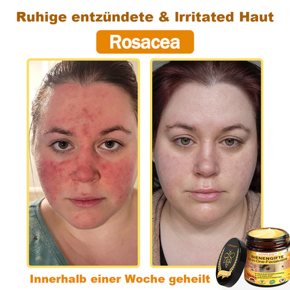 [offizieller Markenshop] 🐝 LOVILDS™ Bienengift-All-Action-Creme (👩‍⚕️ Deutsche Dermatologische Gesellschaft e.V. 𝟐𝟎𝟐𝟓Besonders empfehlenswerte Produkte)💟
