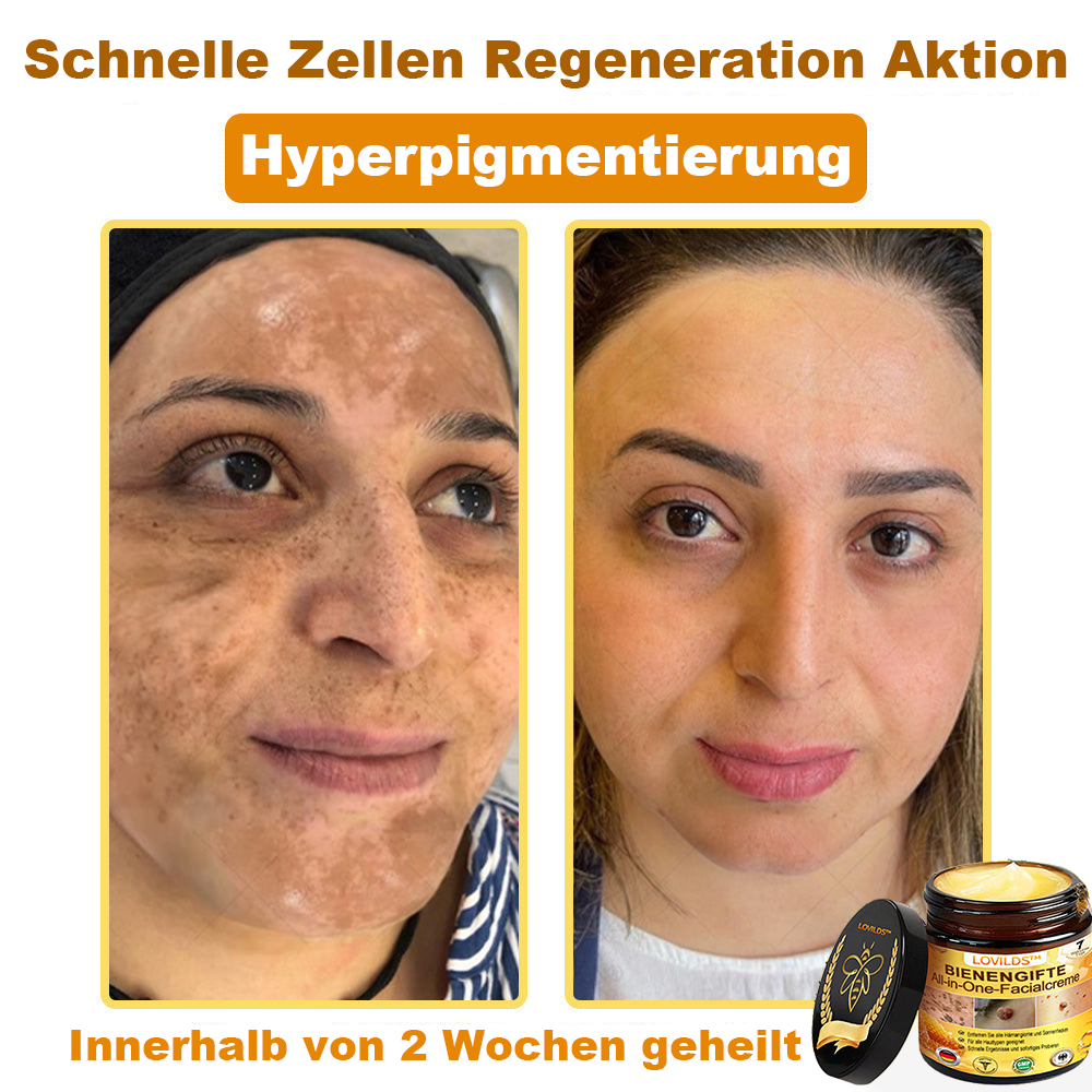 [offizieller Markenshop] 🐝 LOVILDS™ Bienengift-All-Action-Creme (👩‍⚕️ Deutsche Dermatologische Gesellschaft e.V. 𝟐𝟎𝟐𝟓Besonders empfehlenswerte Produkte)💟