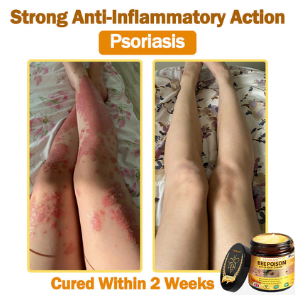 [𝐎𝐟𝐟𝐢𝐜𝐢𝐚𝐥 𝐁𝐫𝐚𝐧𝐝 𝐒𝐭𝐨𝐫𝐞] 🐝 LOVILDS™ 𝐁𝐞𝐞 𝐕𝐞𝐧𝐨𝐦 𝐀𝐥𝐥-𝐢𝐧-𝐎𝐧𝐞 𝐂𝐫𝐞𝐚𝐦 (👩‍⚕️𝐁𝐫𝐢𝐭𝐢𝐬𝐡 𝐀𝐜𝐚𝐝𝐞𝐦𝐲 𝐨𝐟 𝐒𝐜𝐢𝐞𝐧𝐜𝐞 𝐨𝐟 𝐃𝐞𝐫𝐦𝐚𝐭𝐨𝐥𝐨𝐠𝐲 𝟐𝟎𝟐𝟓 𝐒𝐩𝐞𝐜𝐢𝐚𝐥𝐥𝐲 𝐑𝐞𝐜𝐨𝐦𝐦𝐞𝐧𝐝𝐞𝐝 𝐏𝐫𝐨𝐝𝐮𝐜𝐭)💟