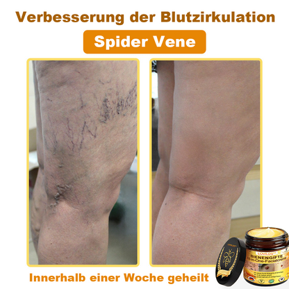 [offizieller Markenshop] 🐝 LOVILDS™ Bienengift-All-Action-Creme (👩‍⚕️ Deutsche Dermatologische Gesellschaft e.V. 𝟐𝟎𝟐𝟓Besonders empfehlenswerte Produkte)💟